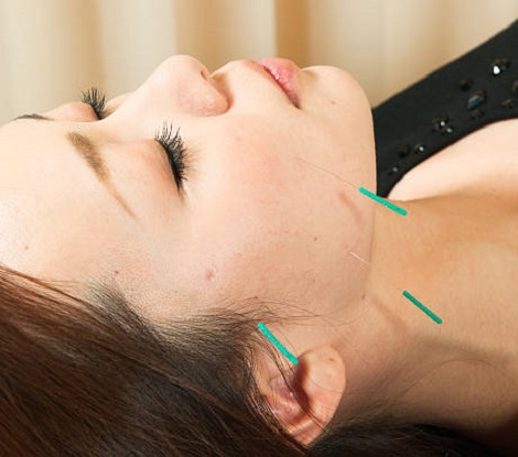 Acupuncture For Women’s Health